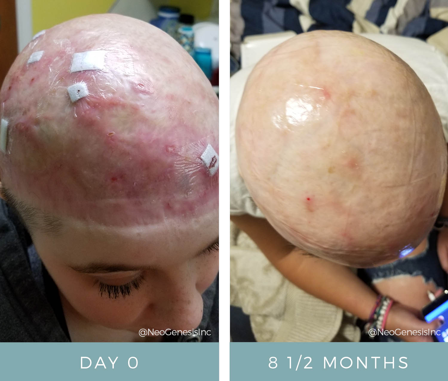 Before + After - Post surgery skin care