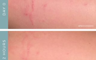 Before + After - Allergic Reaction